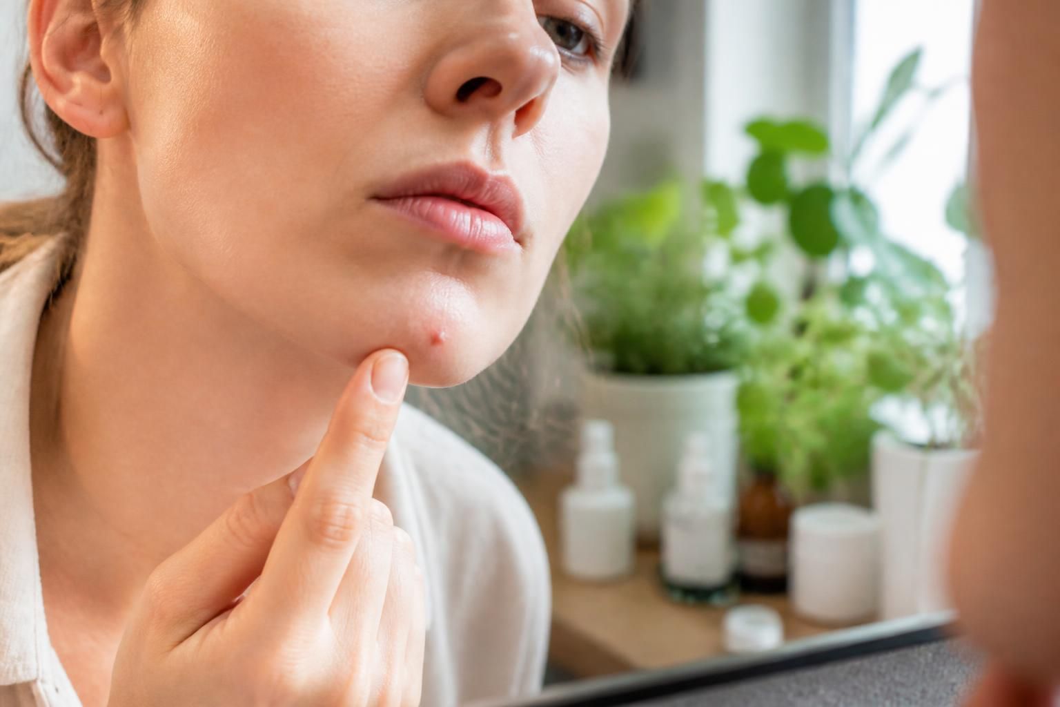 découvrez ce que la présence d'un bouton sur le menton peut révéler sur votre santé et comment interpréter cet emplacement pour mieux comprendre votre corps.