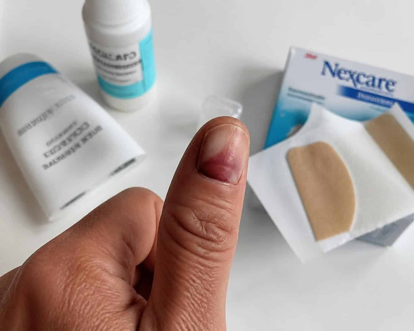 découvrez comment réparer efficacement une matrice d’ongle détruite grâce à nos conseils experts pour restaurer la santé et la beauté de vos ongles.