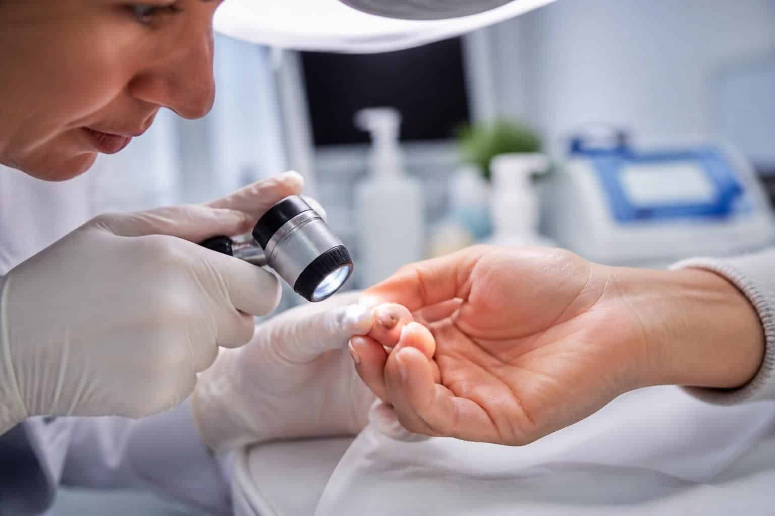découvrez des solutions efficaces pour réparer une matrice d'ongle endommagée et retrouver des ongles sains et résistants rapidement.